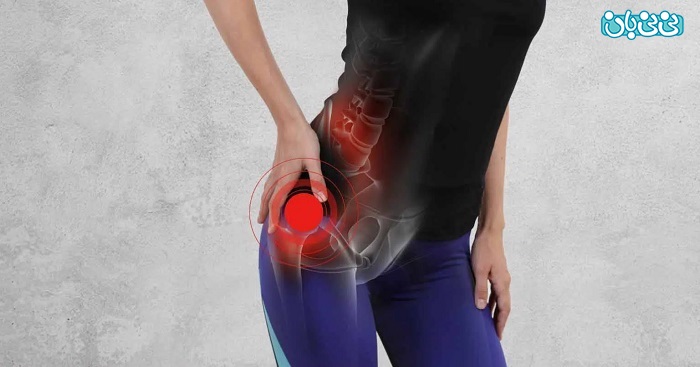 دردهای لگنی در زنان چه دلایلی دارد؟ خطرناک است؟