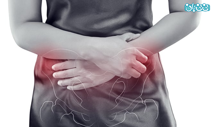 دردهای لگنی در زنان چه دلایلی دارد؟ خطرناک است؟