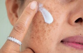با منافذ باز پوست چه کنیم؟/ این منافذ به طور قطعی درمان می‌شوند؟