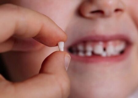دندان‌های شش‌سالگی؛ دندان‌هایی مهم اما فراموش شده در کودکان