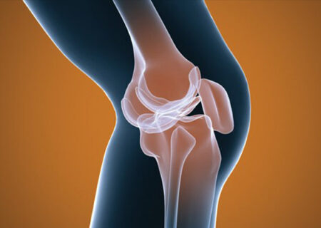 پرتودرمانی به تسکین درد آرتروز زانو کمک می کند