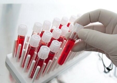 ۱۰ هزار لیتر پلاسمای ضد هاری؛ نیاز ضروری برای تامین دارو