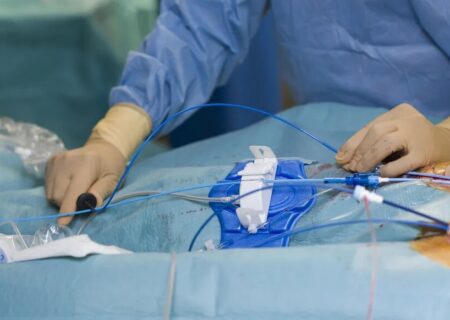 روش طلایی تشخیص تنگی عروق قلب در بیماران