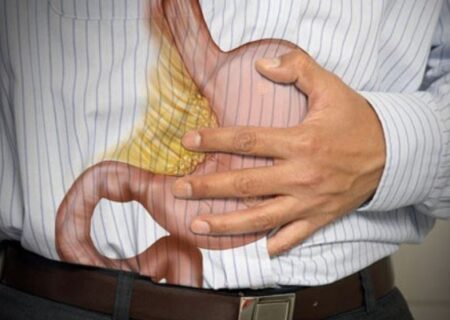 زخم معده پس از درمان کامل نیاز به مصرف طولانی‌مدت دارو ندارد