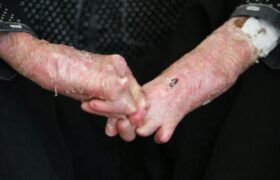 ضرورت اطلاع‌رسانی درباره ازدواج‌های فامیلی و بیماری‌های ژنتیکی