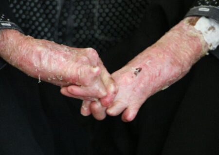 ضرورت اطلاع‌رسانی درباره ازدواج‌های فامیلی و بیماری‌های ژنتیکی