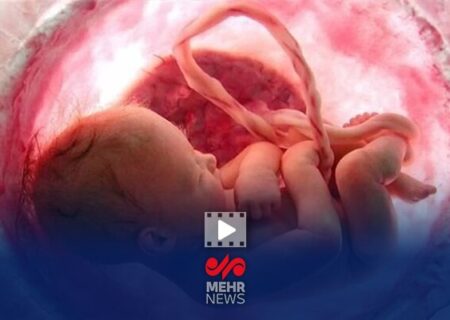 کاهش چشمگیر آمار سقط جنین در کشور با اجرای طرح «نفس»