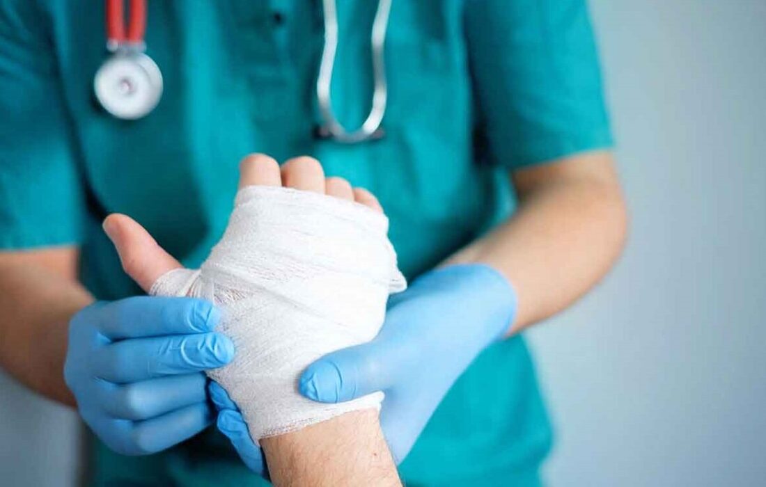 ۹۰ درصد سوختگی‌ها قابل پیشگیری است