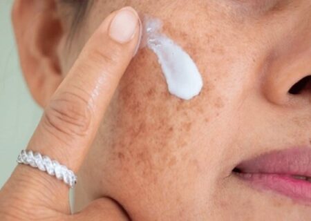 آلودگی هوا و پوست؛ چگونه از التهاب و خطر سرطان پیشگیری کنیم؟