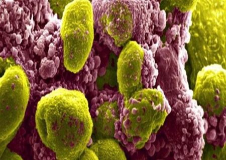 تاثیر یک ترکیب دارویی در کاهش خطر مرگ ناشی از سرطان