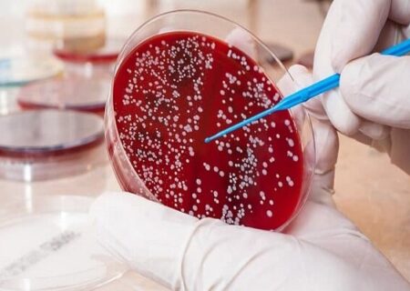 افزایش نگران‌کننده سرطان روده بزرگ در ایران