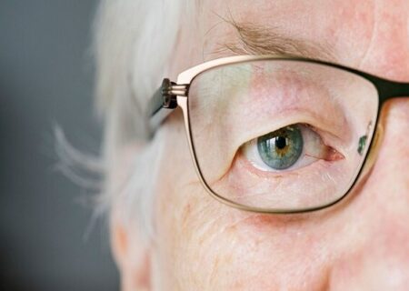 پیرچشمی چیست و چه زمانی بروز می‌کند؟