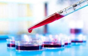 آزمایش خون می‌تواند بیماری کرون را پیش‌بینی کند