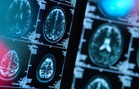 هشدار به بیماران صرعی و آسمی درباره قطع دارو در ایام روزه‌داری