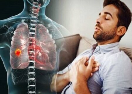 راهنمای حیاتی نجات؛ چگونه در شرایط بحرانی حمله آسم را مهار کنیم؟